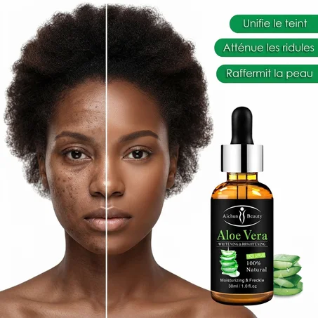 Huil naturel pour le visage - Contrôle de l'acné