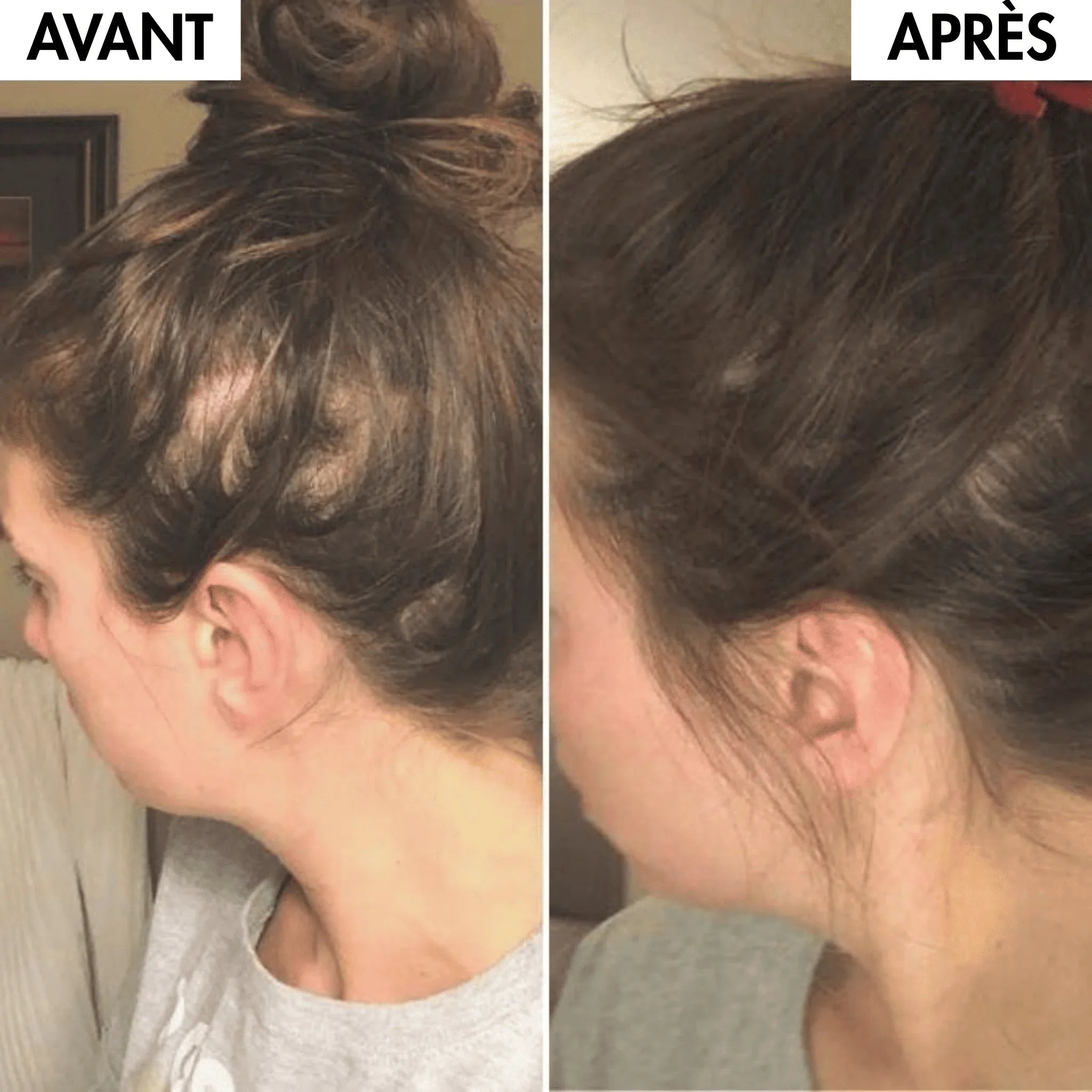 elixir capillaire luxe ( Huile anti chute )