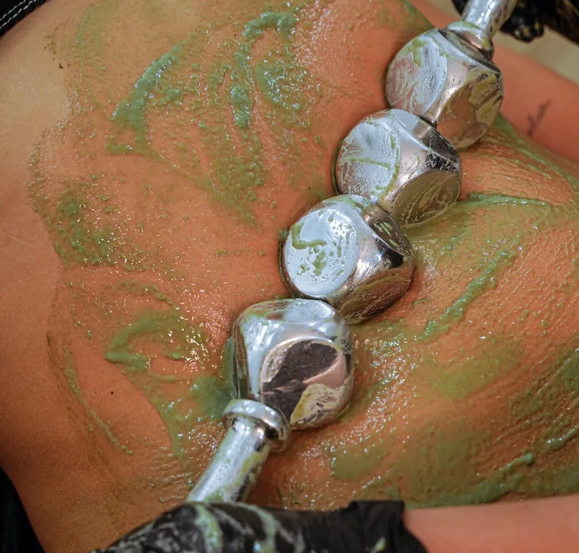 Matériel Madéro ICE