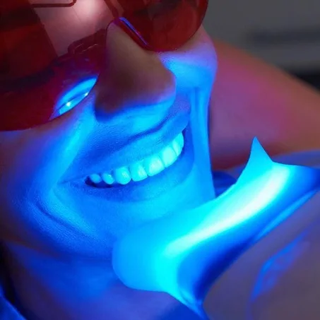 Blanchiment dentaire