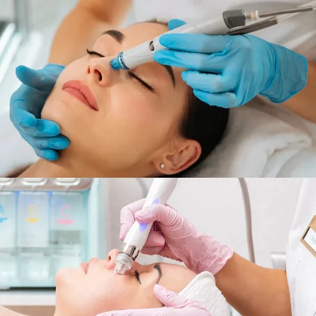 Soin hydrafacial