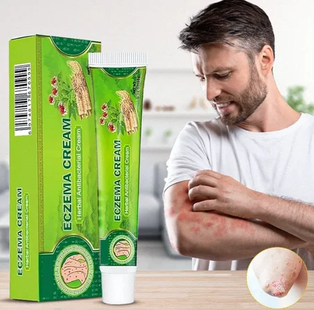 Eczema Cream
