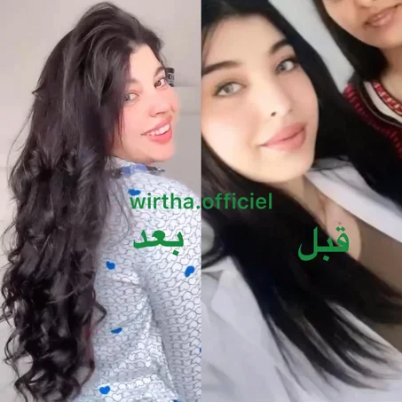 زيت ورثة لعلاج تساقط الشعر وملء الفراغات