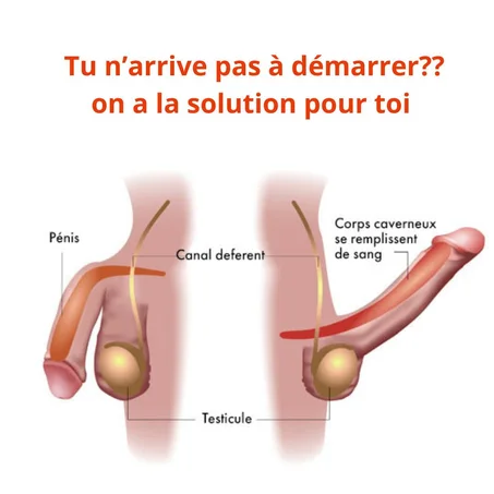 TU VERSE VITE!,VIENT PRENDRE TON PRODUIT  NATUREL  100% BIO  POUR FINI AVEC CETTE HUMILIATION!!!