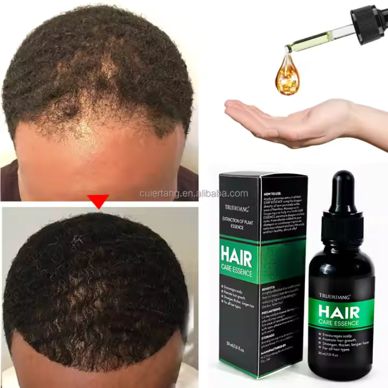 زيت الزنجبيل لتساقط ابلشعر