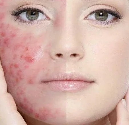 كل ما يخص الصحة و الجمال