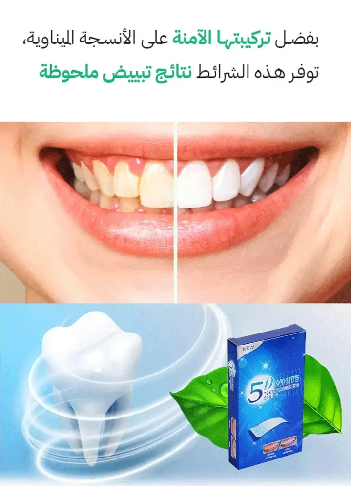 شرائط تبييض الأسنان