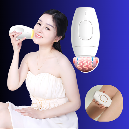 جهاز ازالة الشعر بالليزر