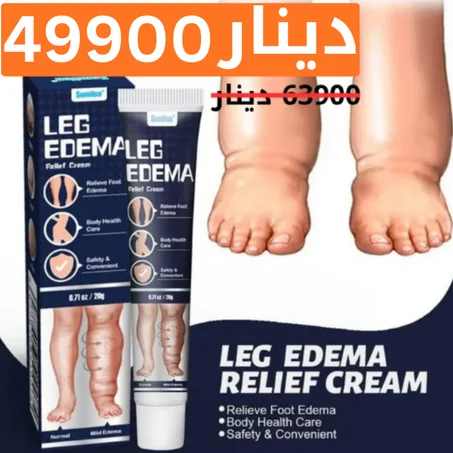 كريم مضاد لتورم الساقين