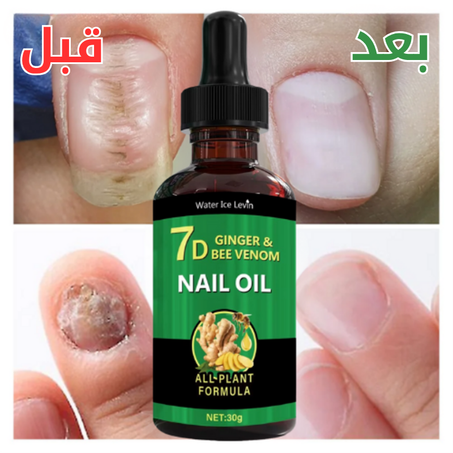علاج طبيعي مضاد للفطريات للأظافر (IQ)