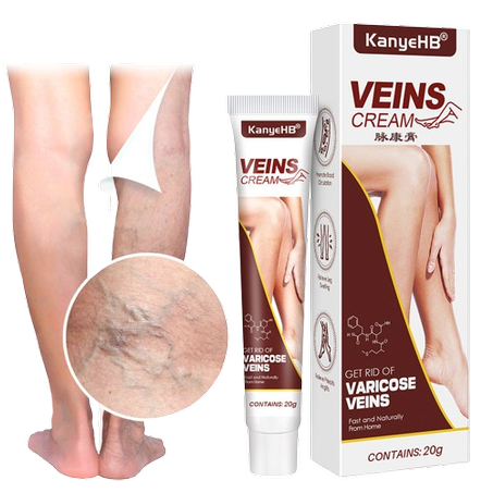 كريم لتخفيف دوالي الأوردة