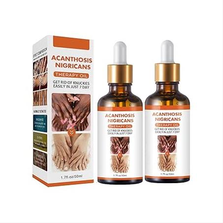 زيت علاج الشواك الأسود