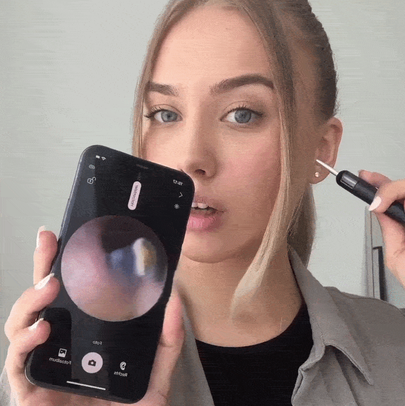 Nettoyeur d'oreille avec caméra HD