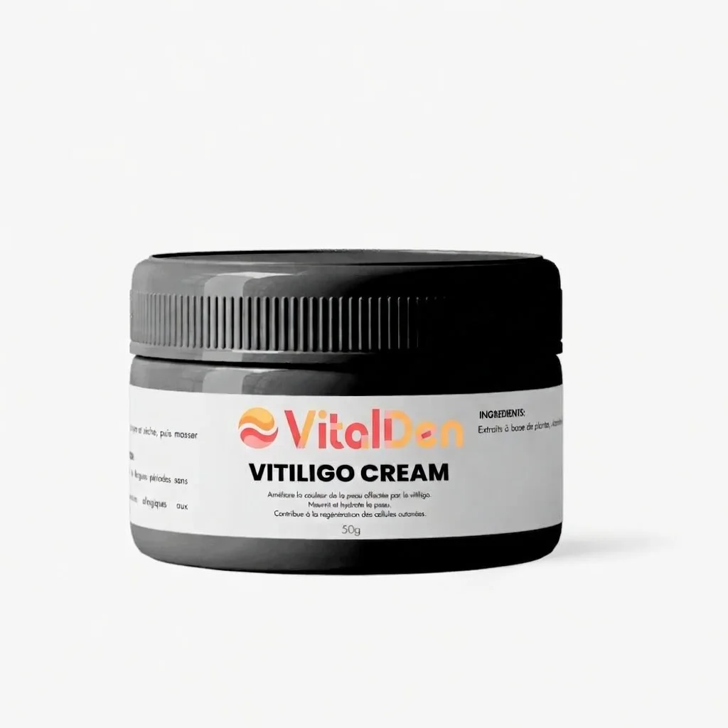 Crème Vitiligo      كريم البهاق
