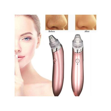 جهاز إزالة الرؤوس السوداء