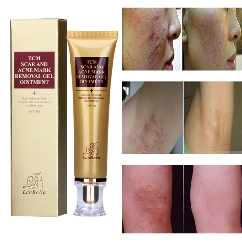 كريم ازالة اثر الحبوب، الحروق،  الكلف وتبيض الوجه