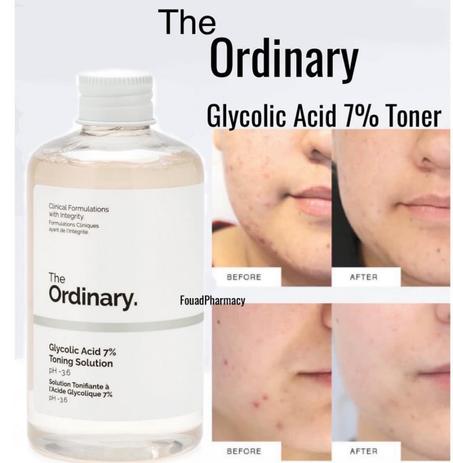 تونر اوردناي السحري لحل لكل المشاكل