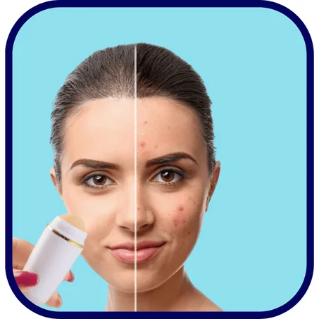 الة امتصاص الزيوت على الوجه