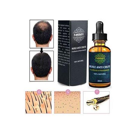 Parodex Sérum de croissance des cheveux, contre la perte de cheveux, Traitement pour homme et femme, anti chute des cheveux 30ML