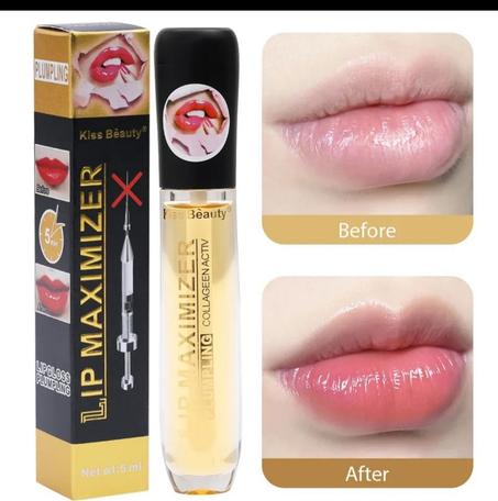 کلوص منفخ الشفاه