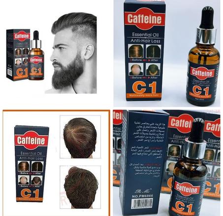 تخلص من فراغات الشعر في رأسك وايضا من تساقط الشعر