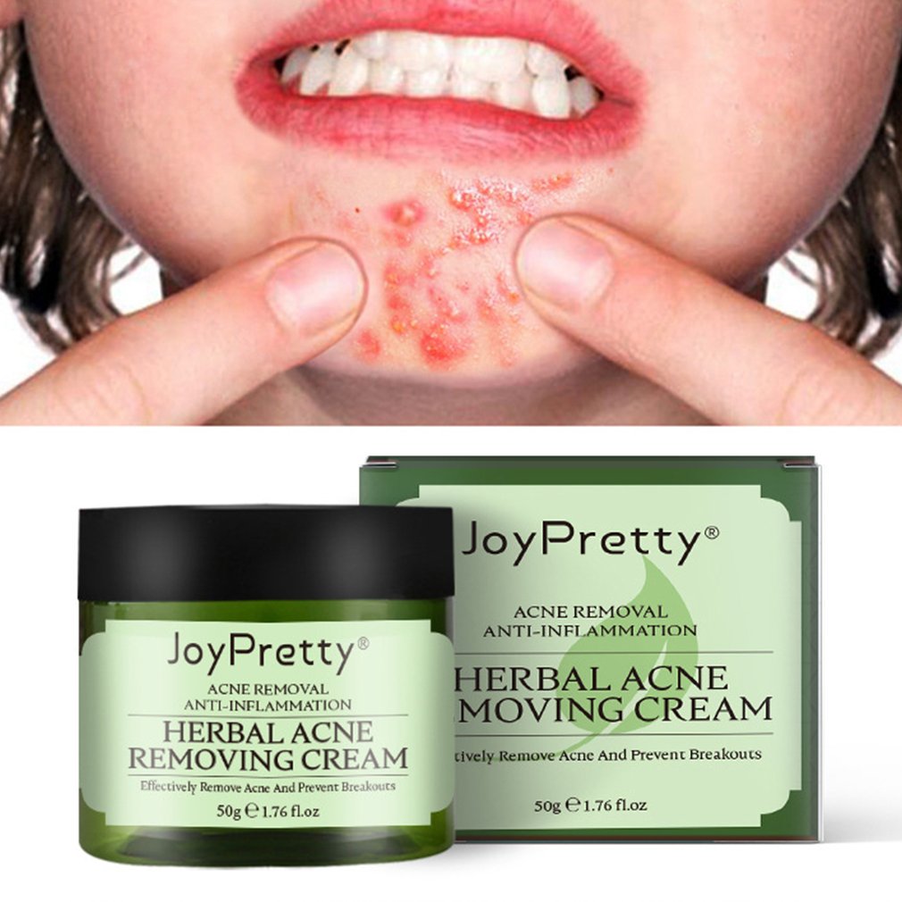 Acne Protection Cream