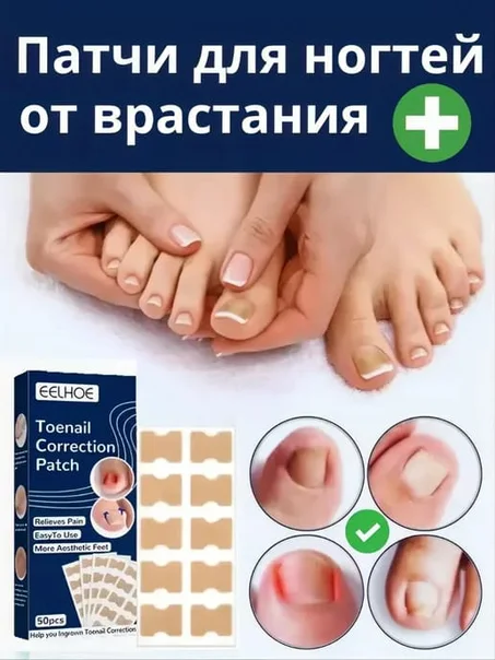 لاصق تصحيح أظافر القدم