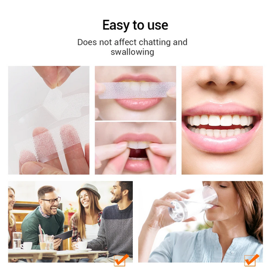 Teeth Whitening Strips