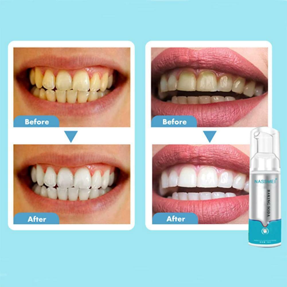 Teeth Whitening Foam