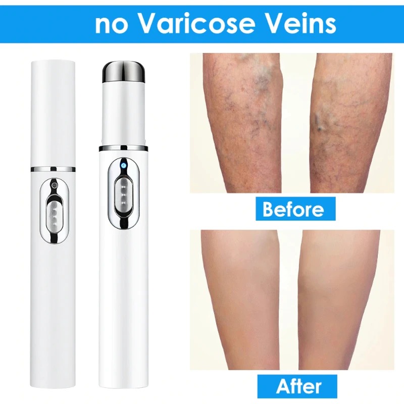 Laser pen For Skin Care