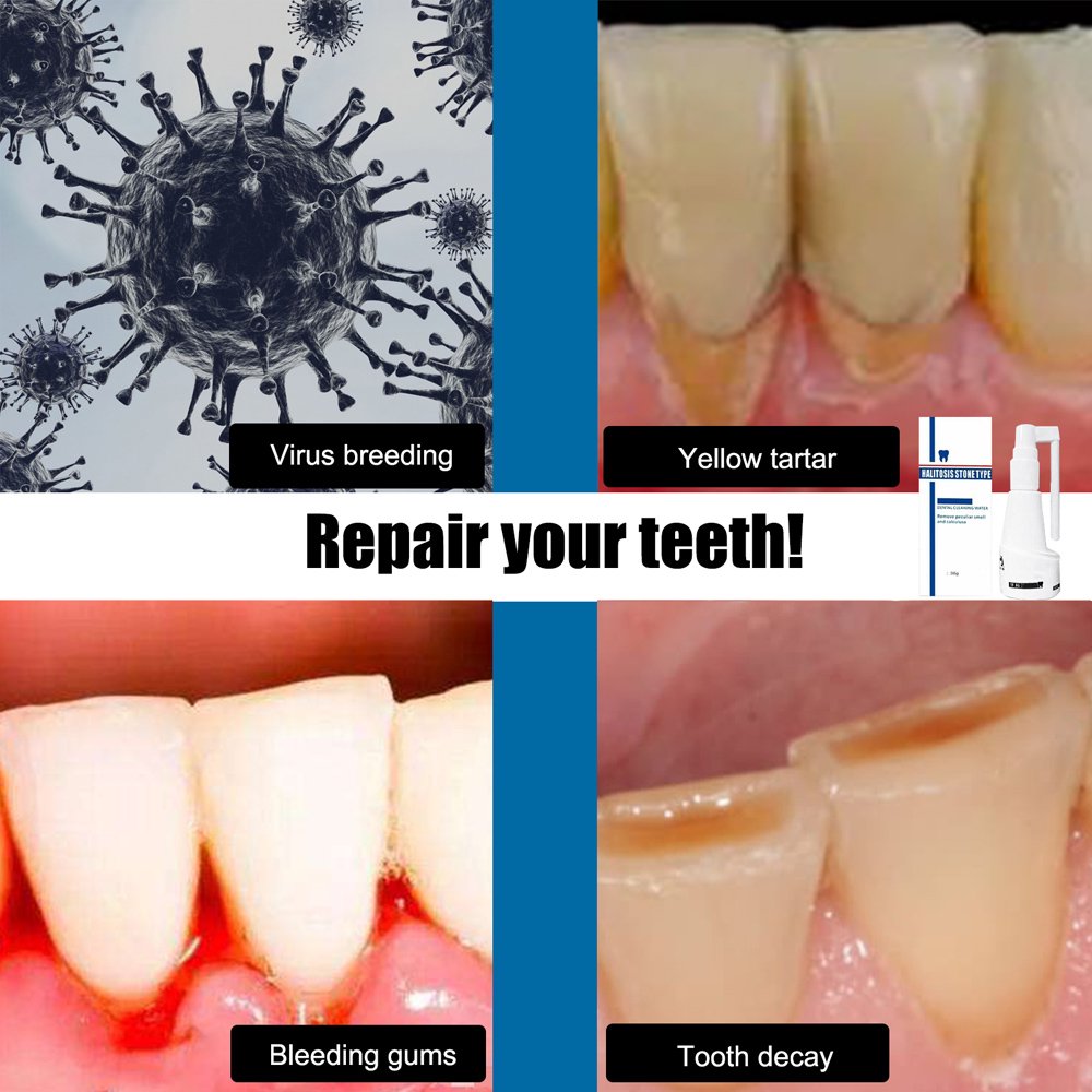 Teeth Whitening Spray