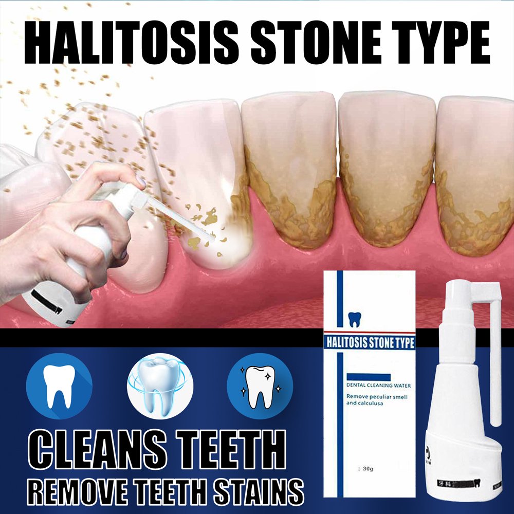 Teeth Whitening Spray