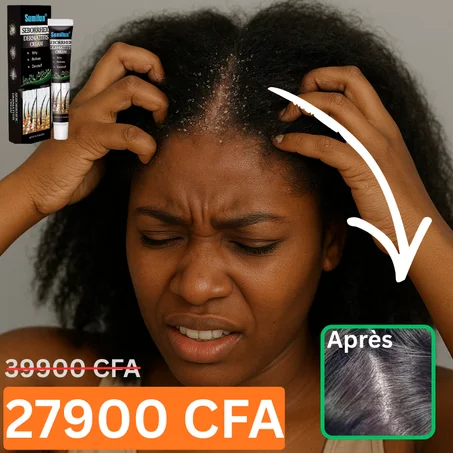 Crème naturelle pour traiter les pellicules et les démangeaisons excessives (GNF)