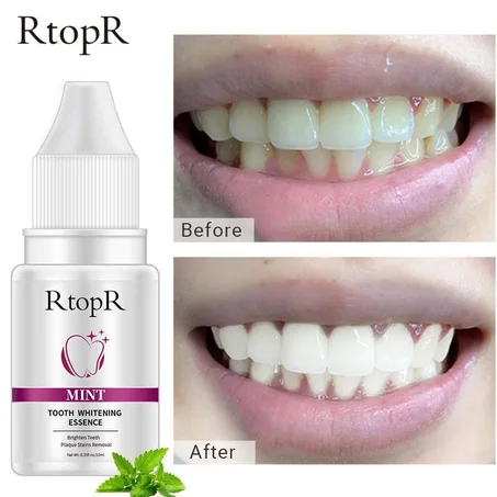 RtopR tooth whitening essence