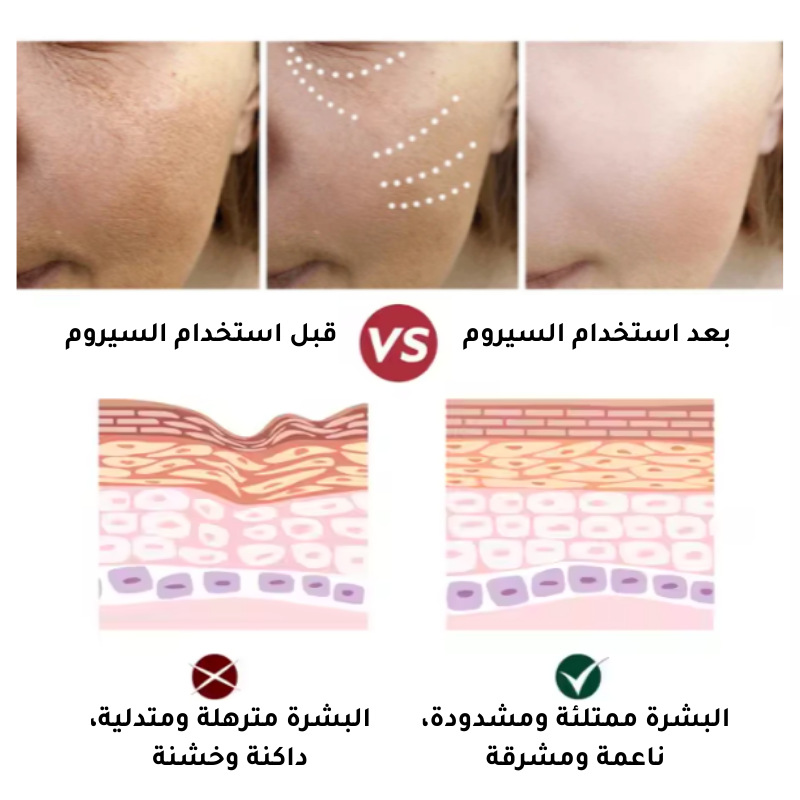 سيروم الريتينول لمكافحة التجاعيد وشد البشرة