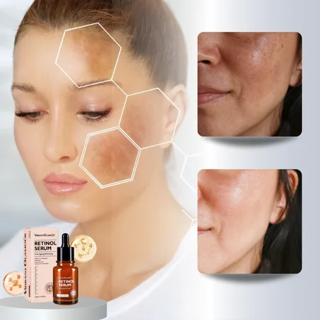 سيروم الريتينول لتفتيح البقع الداكنة
