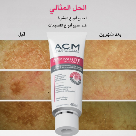 ACM Depiwhite advanced