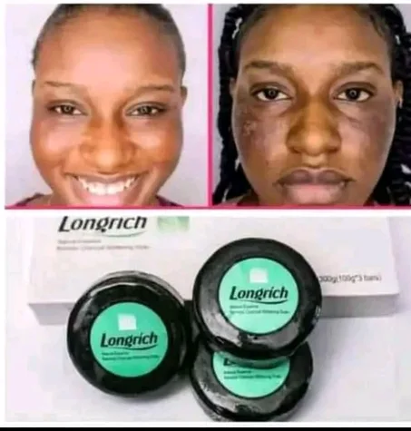 SOLUTIONS BIO CONTRE : BOUTONS, TÂCHES NOIRE, DARTRES,CERNES,
