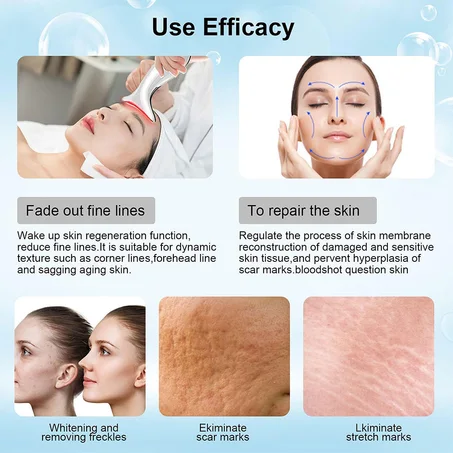 Soin Visage Anti-Rides par Ultrasons – جهاز العناية بالبشرة المضاد للتجاعيد