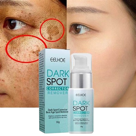 ودّعي البقع الداكنة والنمش، وعيشي إشراقة بشرة جديدة