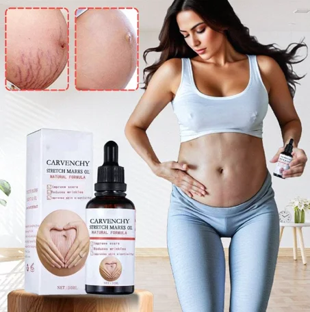 زيت إزالة علامات التمدد