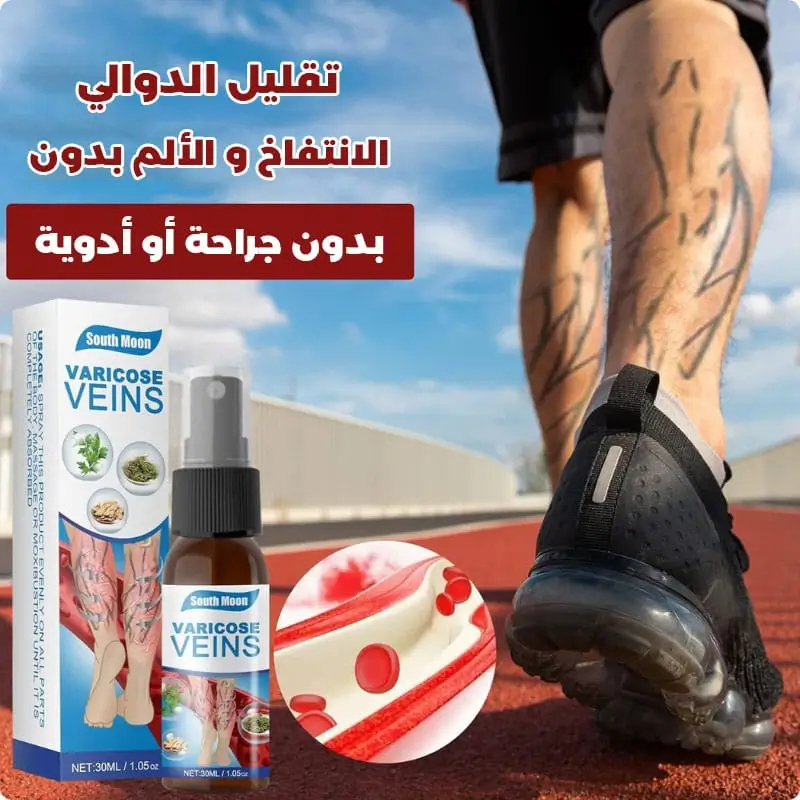 أفضل علاج للدوالي