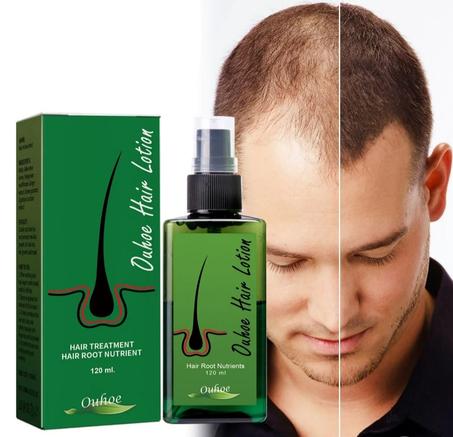 زيت duhoe hair lotion لتكثيف و تقوية الشعر
