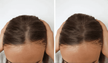 stores/44c5d6d3acaffa69583c4c3282e7c2ba/products/q0PcBkUZFWPflDBCstDQKNsqFVuRG6gwuHjvBVJH.png