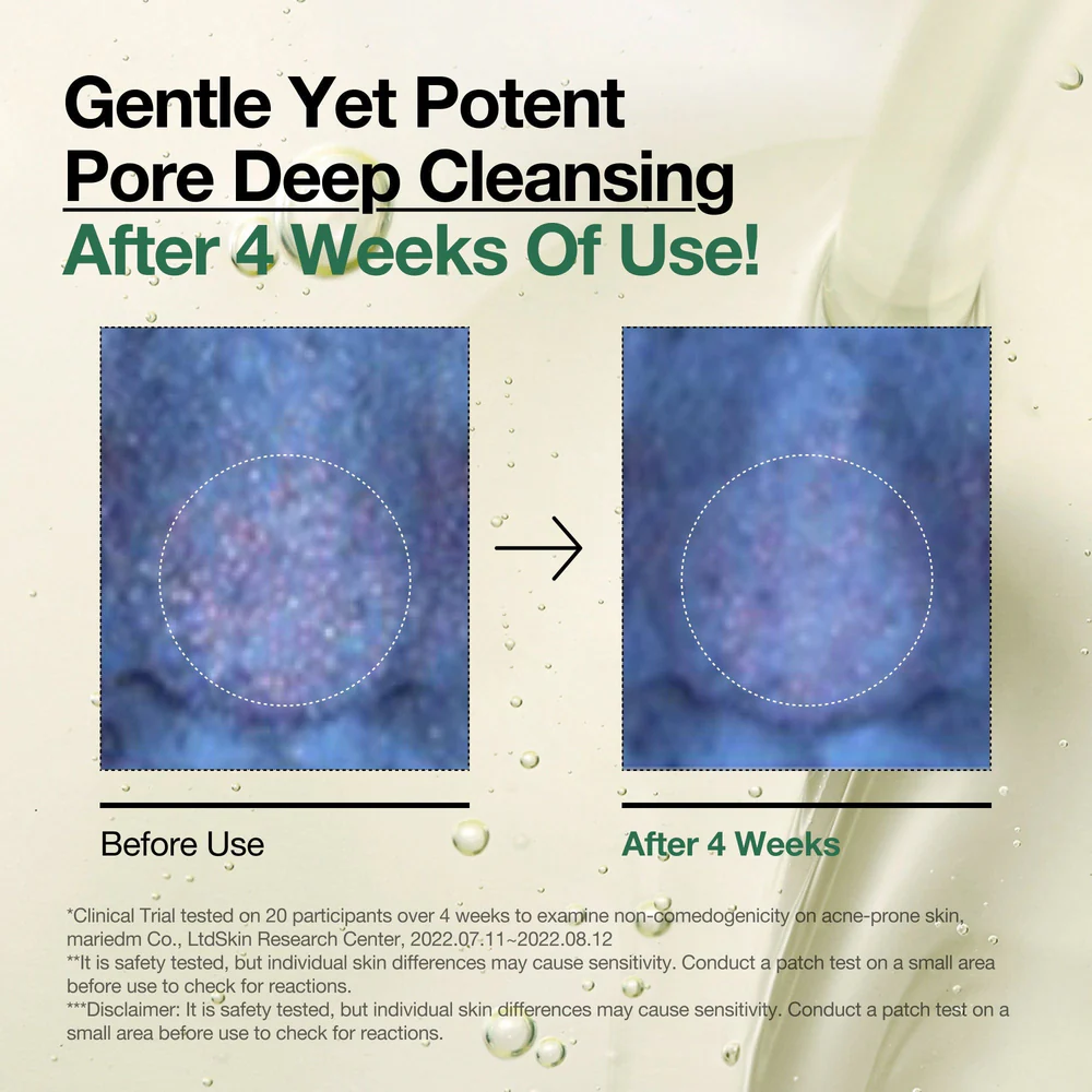 ANUA Double Cleansing Duo Set  - طقم التنظيف المزدوج بخلاصة Heartleaf – لبشرة صافية ونقية كالكريستال 🌿