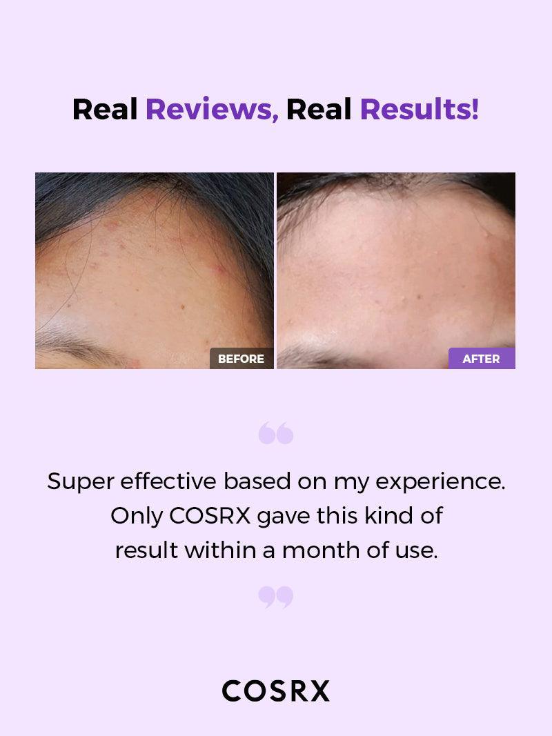 COSRX AHA/BHA Clearfying Treatment Toner (150ml) (Original) - تونر مرطب ومنظف للمسام – ترطيب، توازن، وتجديد في خطوة واحدة