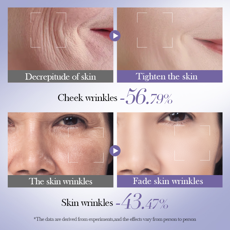 Bioaqua - Retinol Skin Set (Original) مجموعة العناية بالبشرة المتكاملة | 6 قطع