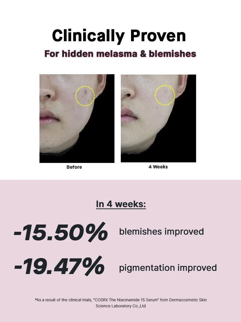 COSRX The Niacinamide 15 Serum - سيروم النياسيناميد 15 لعلاج حب الشباب والتهاب البشرة