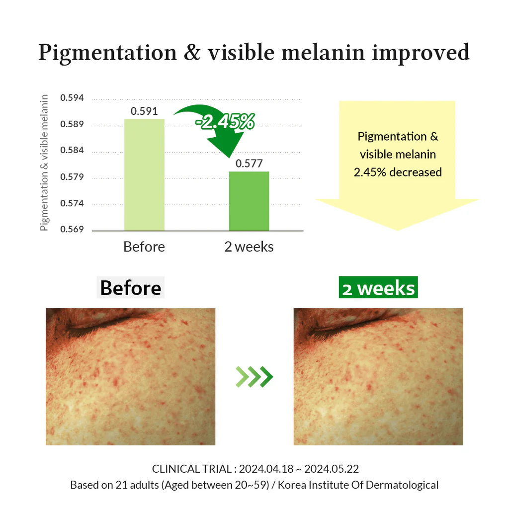 سيروم فيتامين C اللطيف – تفتيح وتهدئة للبشرة الحساسة - Dr.Althea Gentle Vitamin C Serum