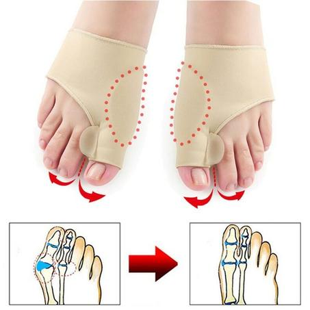 Correcteur orthopédique pour Hallux Vargus - 2 pieces
